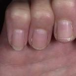Per evitare che le unghie si sfaldino e si rompano: modi per rafforzarle a casa