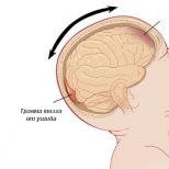 كيفية تحديد ما إذا كان الطفل مصابًا بارتجاج في المخ: العلامات الأولى لماذا يعتبر الارتجاج خطيرًا عند المراهق