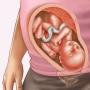 Foto van de foetus, foto van de buik, echografie en video over de ontwikkeling van het kind