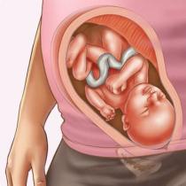 Foto do feto, foto do abdômen, ultrassonografia e vídeo sobre o desenvolvimento da criança